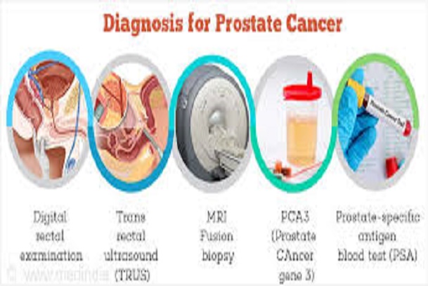 Diagnosing Prostate Cancer; How can we diagnose prostate cancer?