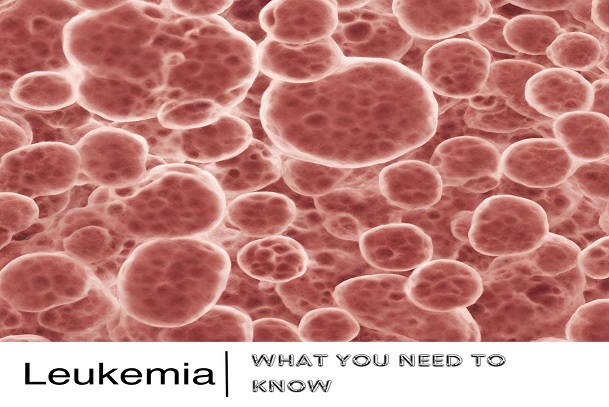leukemia; cancer in children; cancers; what is leukemia; what causes leukemia; how to manage leukemia