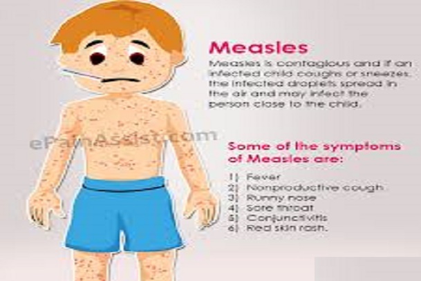 Symptoms of Measles; How does measles look like?; 